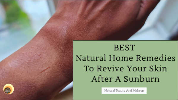 Natural Beauty And Makeup : Best Natural Home Remedies To Revive Your Skin  After A Sunburn