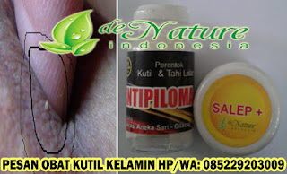 Obat Kutil Kelamin