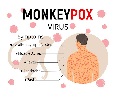 monkeypox monkeypox