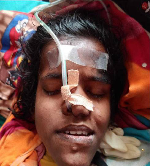 बिहार : पटना में पीएमसीएच के ईएनटी विभाग की मदद से लौटाई मरीज की खोई हुईं आवाज। 