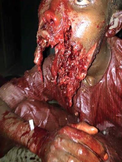 Borno Boko haram Bomb Blast Victim