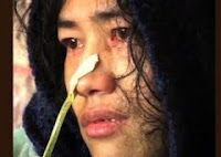 Irom Sharmila Chanu