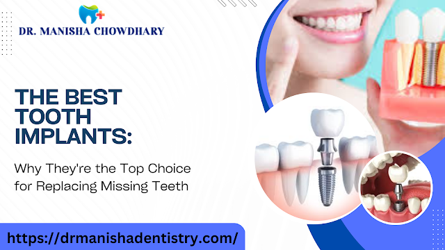 best tooth implants