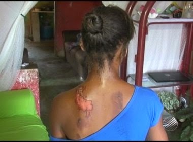 Adolescente é queimada com água quente por vizinha no Sul da Bahia