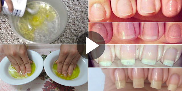 How To Grow Nails Very Fast In 1 Week!