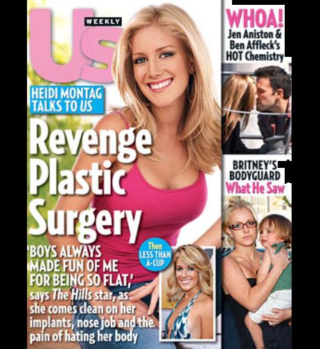 heidi montag surgery before after. 2011 la Heidi Montag and