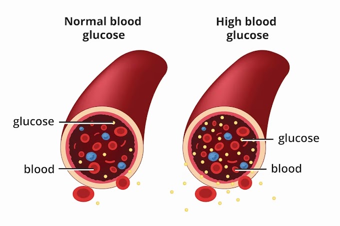    All About Diabetes: Symptoms, Causes, Types.