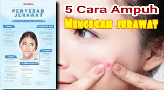 cara mencegah jerawat yang akan tumbuh,cara mencegah jerawat yang akan muncul,cara mencegah jerawat di hidung,cara mencegah timbulnya jerawat dan menghilangkan bekasnya,cara mencegah jerawat pada masa pubertas adalah,cara mematikan jerawat agar tidak tumbuh lagi,produk untuk mencegah timbulnya jerawat,cara menghilangkan jerawat dalam semalam