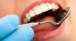 affordable dental implants in dubai