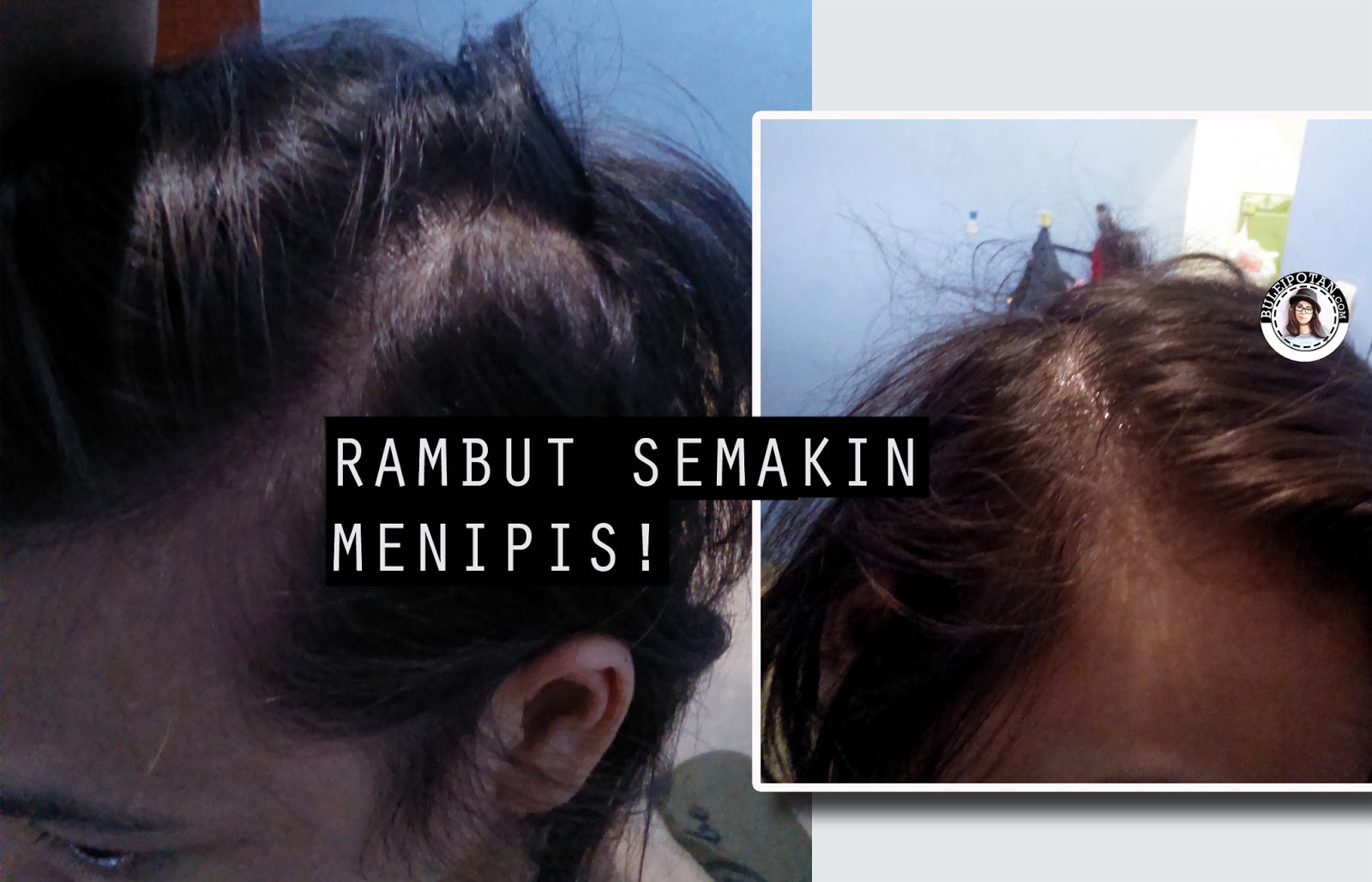 Product Review Ini Perawatan Profesional Untuk Rambut RONTOK