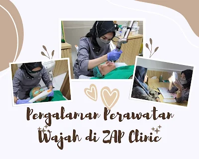 pengalaman perawatan di zap clinic