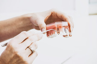 dental implant in gurgaon