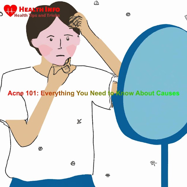 What is Acne? Benefits & Causes, Treatments & Prevention Tips