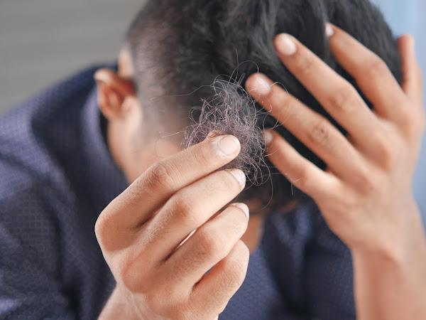 5 hair loss treatments for men in 2023