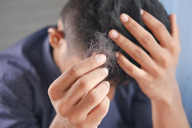 man with head in hand worried about hair loss