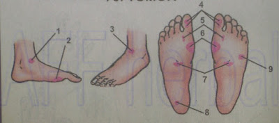 pijat refleksi untuk mengobati tumor