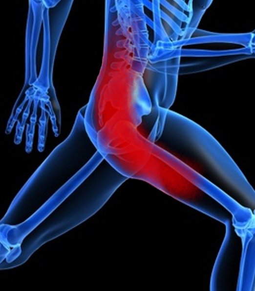 Sciatica is an umbrella term for pain, weakness or numbness caused by 