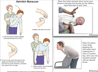 Image result for heimlich maneuver