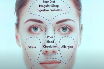 Health Conditions Related to Acne