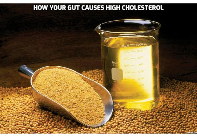 Most nutritional experts advise that in order to prevent cholesterol buildup in arteries, you should cut down the amount of cholesterol and fat in your food. The theory behind this assertion is that cholesterol will go from the food into your bloodstream, where it adds to the blood cholesterol and packs up in your heart arteries. But this is not what happens at all. In fact, there is a little process that is occurring in your guts that may be the main reason for your high cholesterol level.