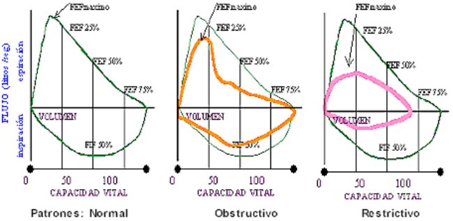 Patrones de la curva de espirometría