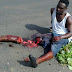 Man Leg Cut-Off In Auto Accident [See Pics]