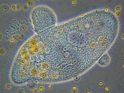 6 Macam Klasifikasi Protozoa Protista Mirip Hewan 