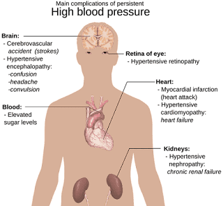 Lower Blood Pressure