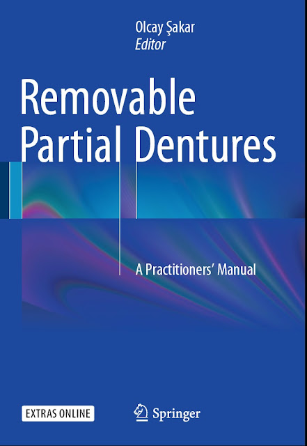 Removable Partial Dentures  A Practitioners’ Manual cover