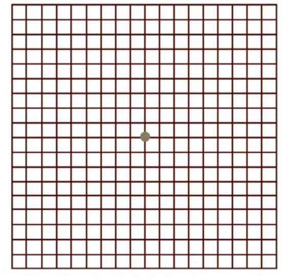 What is Visual Field test ?