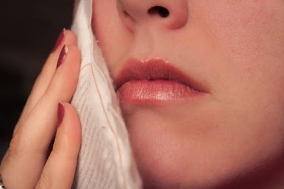 Nhổ dứt điểm răng khôn hàm dưới mọc lệch ra má-1 Nhổ dứt điểm răng khôn hàm dưới mọc lệch ra má-1