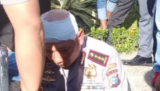 Kepala Kapolresta Pekanbaru Bocor Terkena Lemparan Batu Karena Demo Mahasiswa