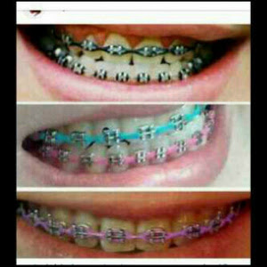 behel gigi babeh dental