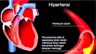 Kesan Ubat Terhadap Hati - 9ppuippippyhytut