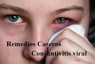 Remedios naturales para la conjuntivitis viral