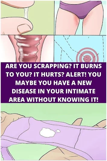 Are You Scrapping? It Burns To You? It Hurts? ALERT! You Maybe You Have A New Disease In Your Intimate Area Without Knowing It!