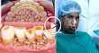 UNBELIEVABLE – Doctors in India Remove 232 Teeth From Mouth Of Teenage Boy