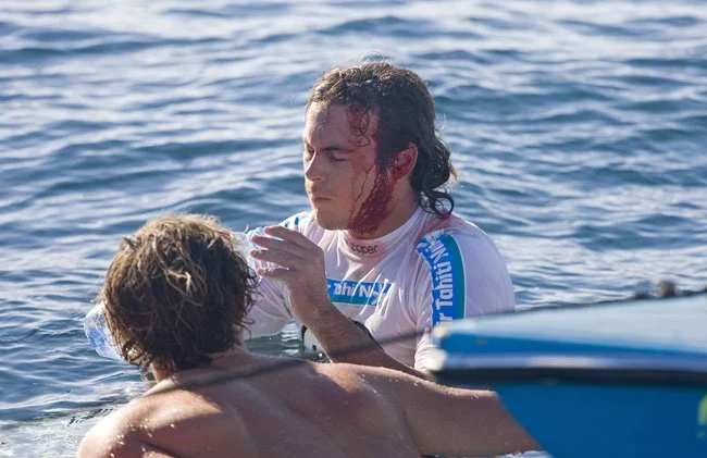 surf30_teahupoo_accidente15
