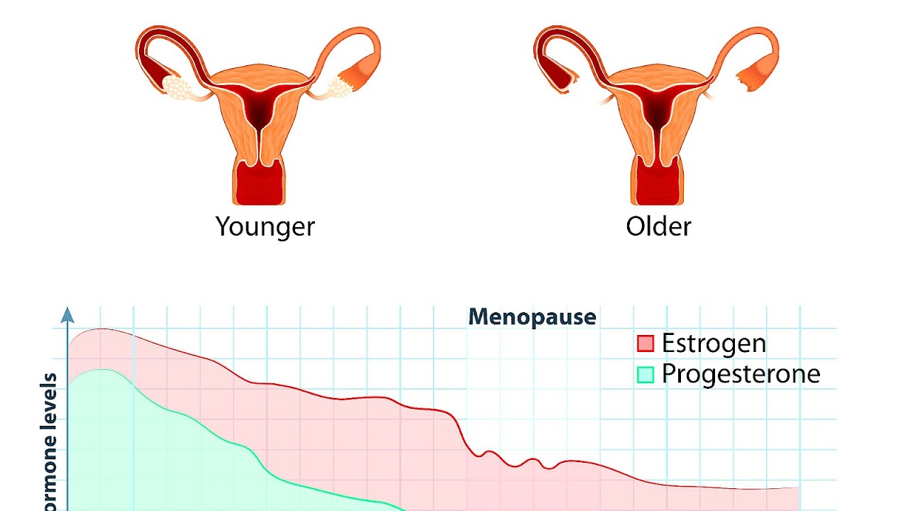 Muscle Pain And Menopause