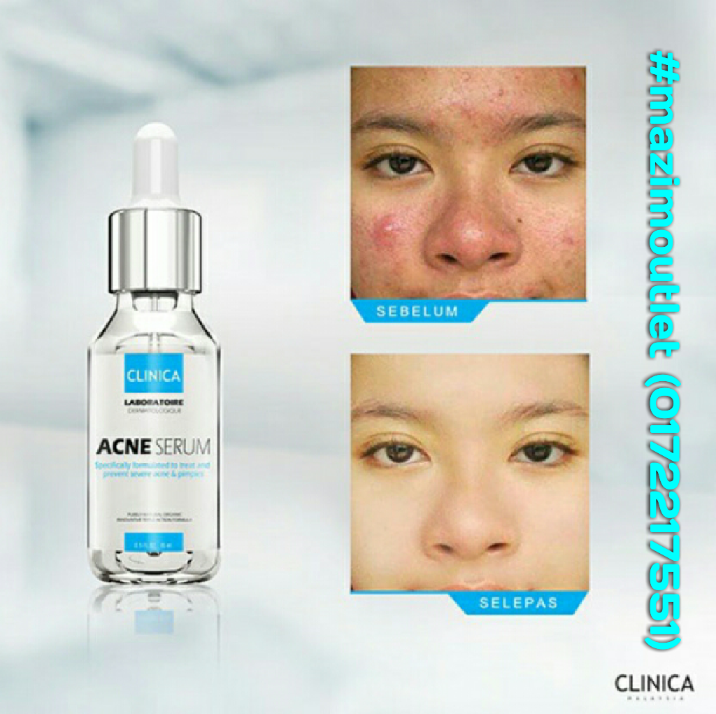 Mazim's Beauty Outlet: Clinica Acne Serum : Ubat Jerawat 