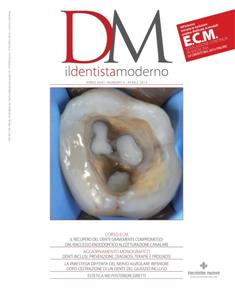 DM Il Dentista Moderno - Aprile 2013 | ISSN 1827-3726 | TRUE PDF | Mensile | Professionisti | Medicina | Odontoiatria | Implantologia
Da oltre trent’anni DM Il Dentista Moderno rappresenta il punto di riferimento per l’informazione tecnica e specializzata per l’odontoiatra; la sua tiratura certificata ne assicura una diffusione capillare.  La rivista è diretta da un Comitato scientifico di grande esperienza e autorevolezza che garantisce la qualità degli interventi.  DM Il Dentista Moderno viene realizzato, mensilmente, con il contributo di docenti universitari e di liberi professionisti e offre, attraverso una rigorosa selezione di articoli, informazioni teoriche, pratiche e operative particolarmente utili nell’attività clinica. Gli abbonati possono iscriversi a corsi ECM on line e acquisire crediti, rispondendo esattamente alle domande proposte alla fine dello studio.
In ogni numero vengono pubblicati lavori che abbracciano tutte le discipline dell’odontoiatria. All’interno, un aggiornamento monografico, articoli sulle più innovative ricerche scientifiche e casi clinici significativi, abstract, rubriche sugli aspetti pratici legati alla professione; un’inchiesta e un’intervista a un personaggio di spicco danno infine un quadro di quello che succede nel settore.