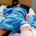 Niño es arrollado por moto y podría perder la pierna