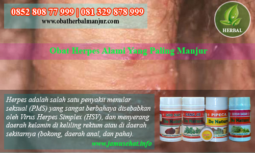 pengobatan herpes alami