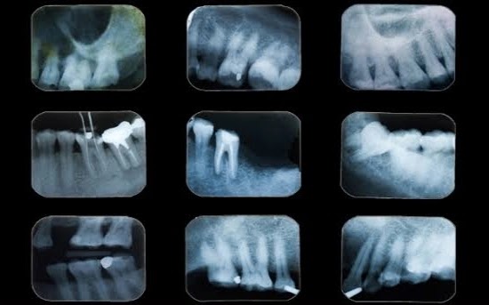 Forensic Odontology