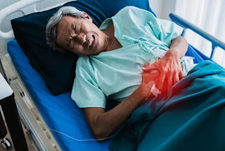 Passing a kidney stone female