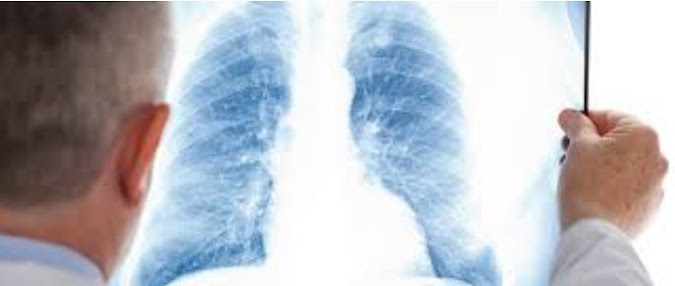  Mesothelioma Asbestos Lawyer - Why You Need a Specialist