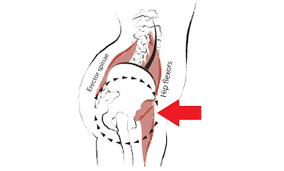 varicocele risk factor (reverse)