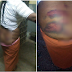 Ghana police officer flogs 29-year-old lady’s buttocks raw for allegedly refusing to enter cell