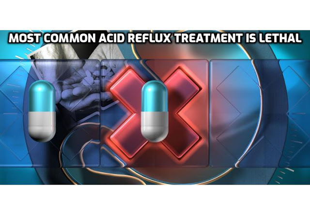 Stop Acid Reflux Safely - How Heartburn Causes Heart Attack (be warned). A new mega-study involving over 3 million people has uncovered a strong and convincing link between heart attack and people who suffer heartburn, acid reflux, and indigestion. But it might not be linked in the way you think. 