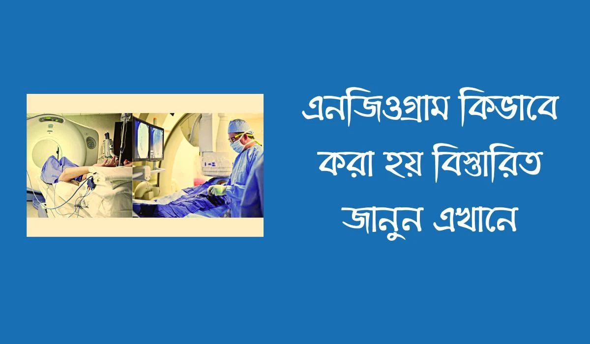 এনজিওগ্রাম কিভাবে করে  এনজিওগ্রাম কিভাবে করা হয়